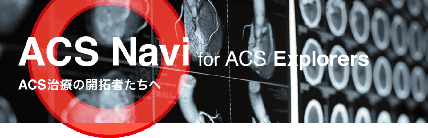 ACS Navi  for ACS Explorers